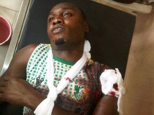 Gambo Mohammed, Ubong Ekpai Shot By Armed Robbers On The Way To Owerri For Heartland Game